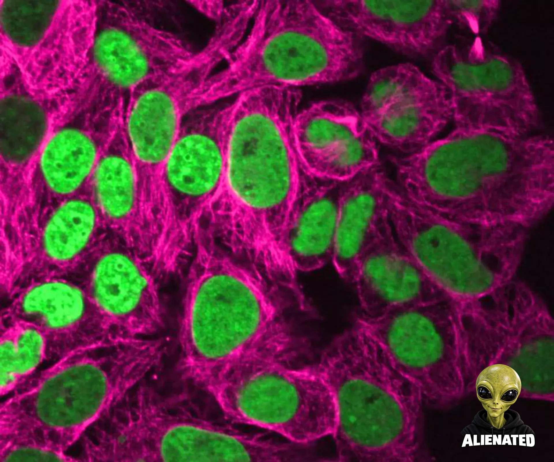 Human cells with fluorescently labeled chromatin (green) and microtubules (magenta) appear elongated after 24-hour exposure to fluid flows. Credit: Kanellakopoulos/Zidovska/NYU